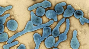 Ilustrasi. Ethiopia konfirmasi wabah virus pertama Marburg usai temuan 9 kasus. (NIAID melalui Wikimedia Commons)